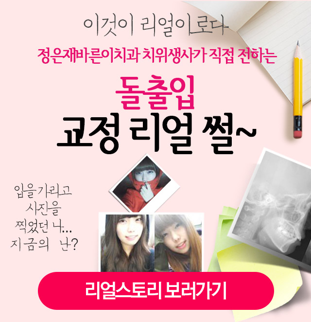 이것이 리얼이로다 정은재바른이치과 치위생사가 직접 전하는 돌출입 교정 리얼 썰~리얼스토리 보러가기